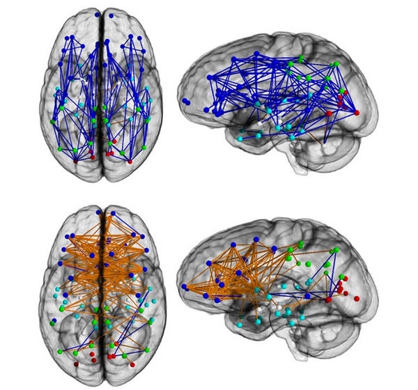 мозговые сети показывают увеличенную возможность соединения по всей длине и в одном полушарии в (верхних) мужчинах и слева направо в женщинах (ниже)