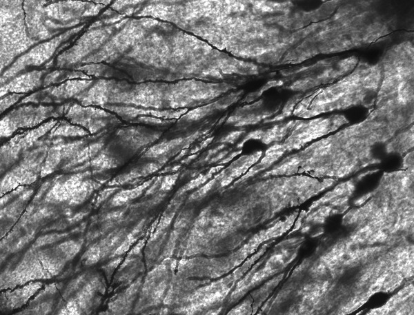 Нейроны. Конфокальная флуоресцентная микроскопия. Каролин Шарлье и Даниэль Дунья.