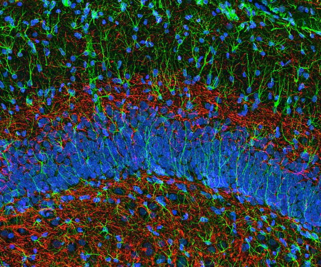 срез через гиппокамп мыши: разные нейроны окрашены разными флуоресцентнымибелками (фото Dr. Thomas Deerinck / Visuals Unlimited / Corbis)